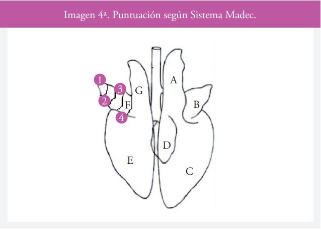 Imagen 4a