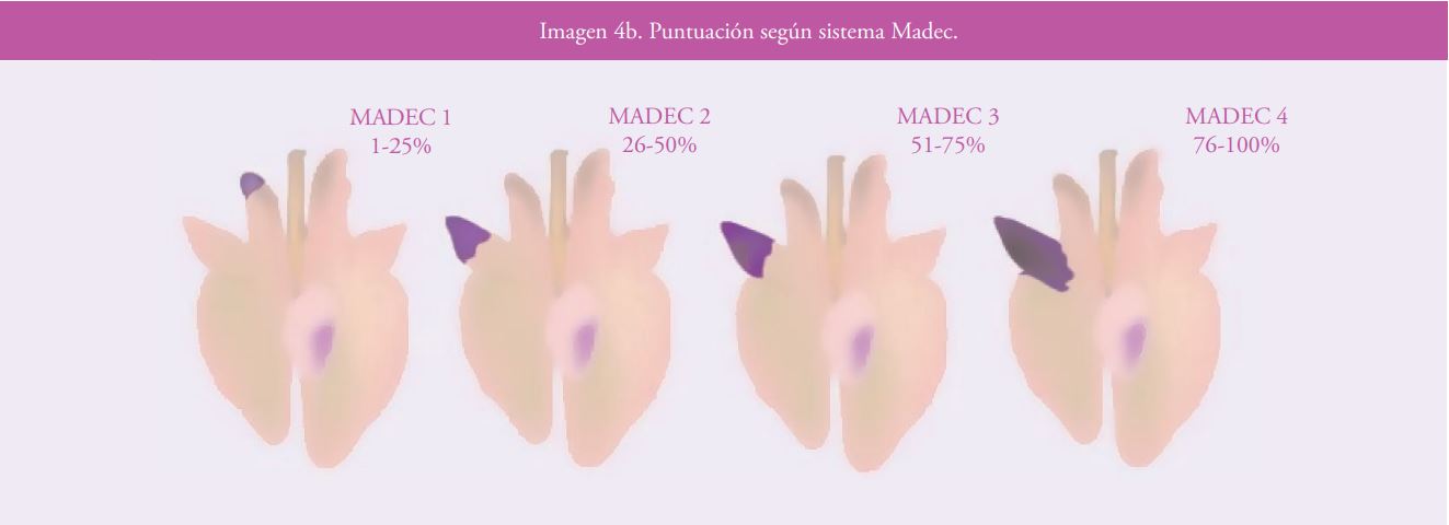 Imagen 4b